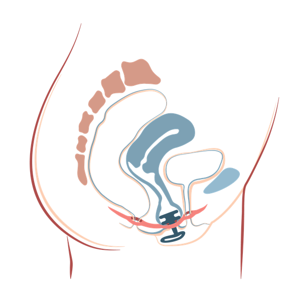 EBS-with-product-inserted-transparent.png